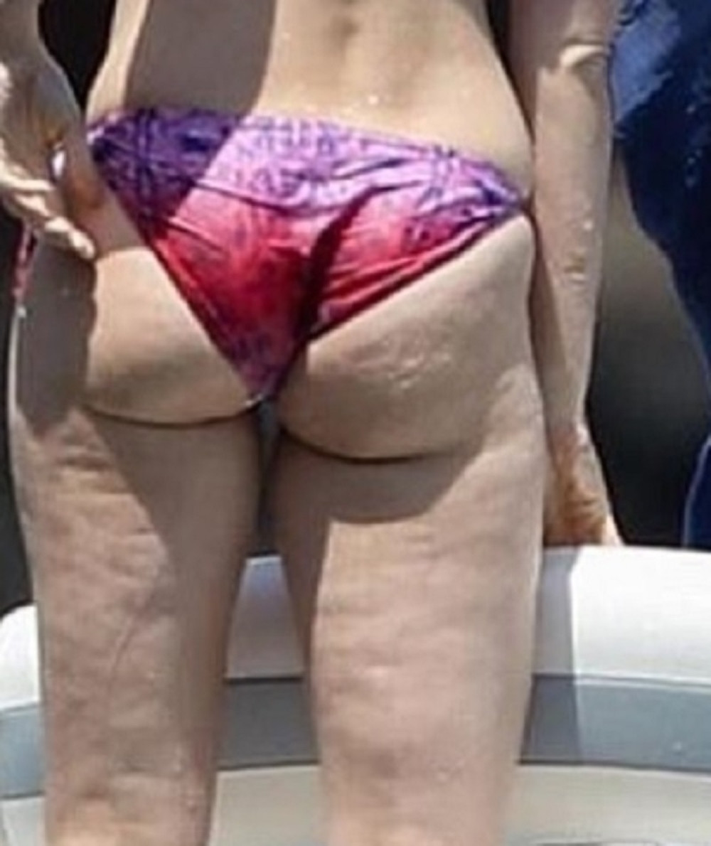 Ako ste skloni celulitu, zaboravite na ove četiri namirnice