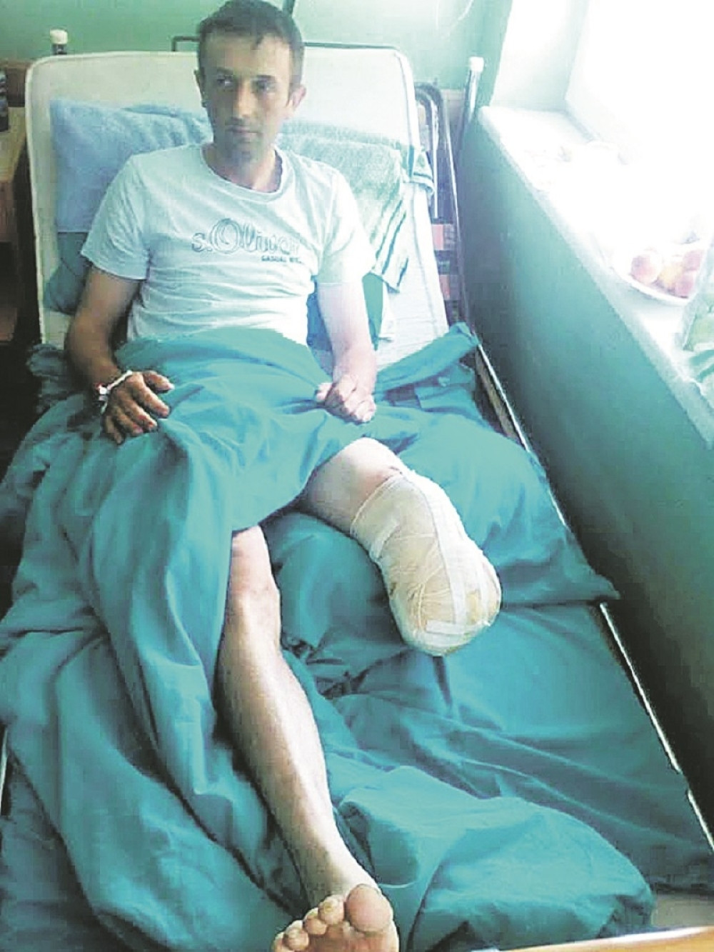 Osećam da mi trne stopalo, onda vidim da ga nemam