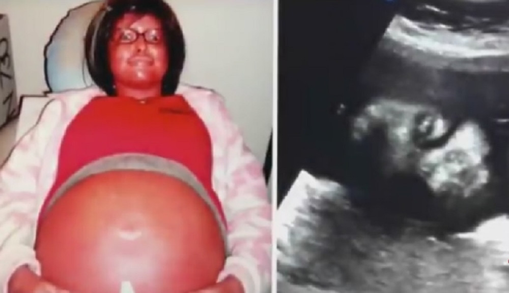 Lekari nikada nisu videli ovakav porođaj, a onda je usledilo ČUDO