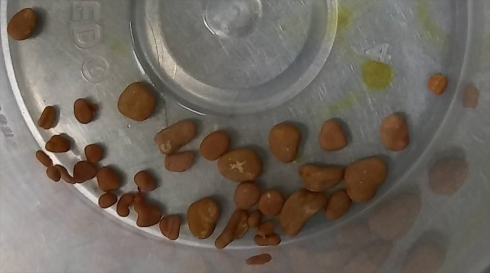 Lekari otvorili pacijentkinju i šokirali se! (FOTO)