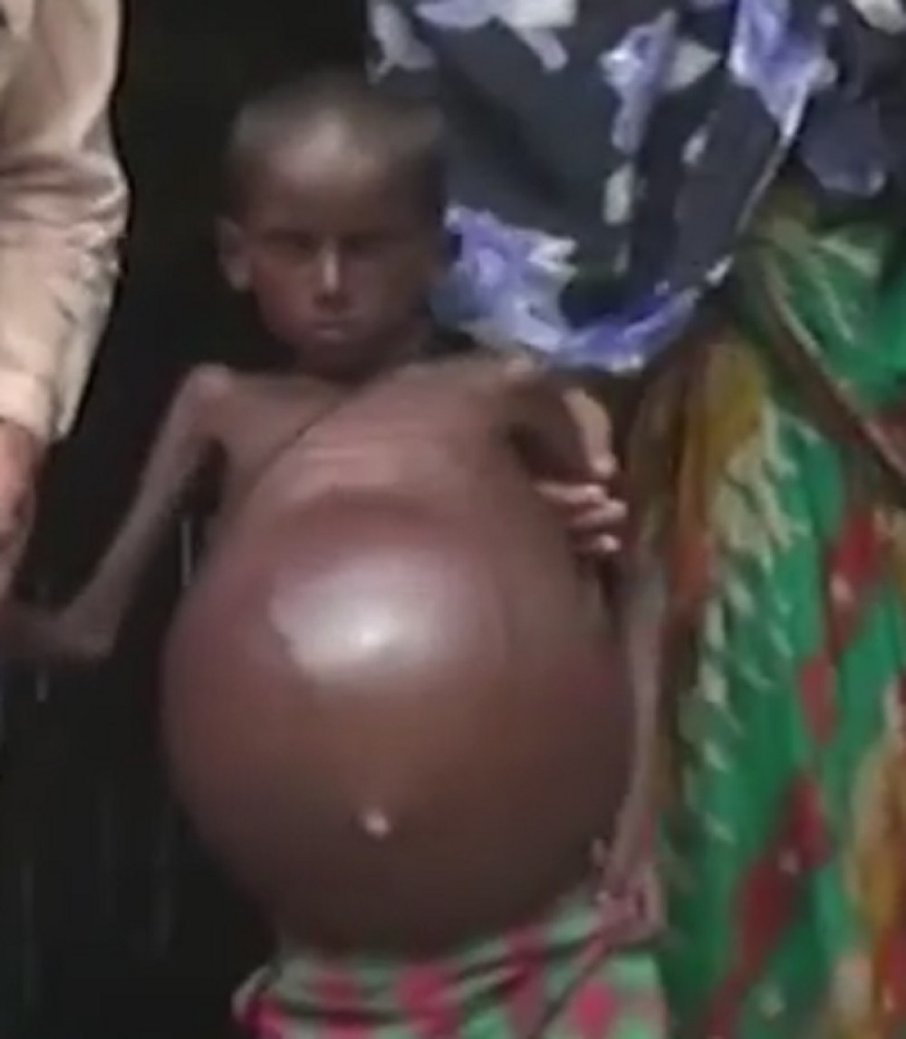 Ovaj dečak ima retku bolest i njegov život je košmar (VIDEO)