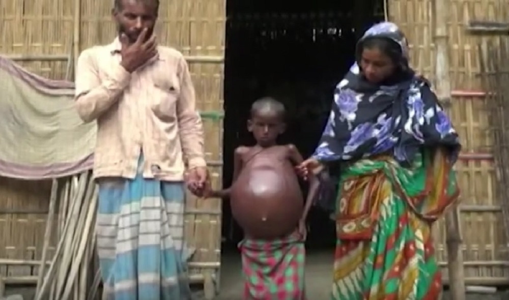 Dečak izgleda kao balon (VIDEO)