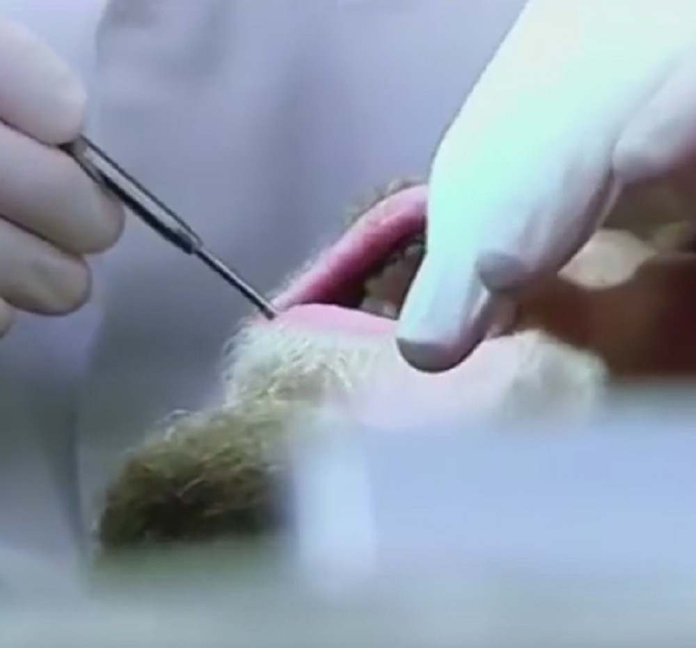 Nije oprao zube 20 godina (VIDEO)