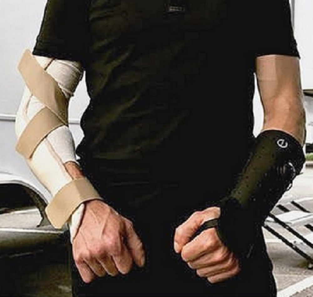 Poznati glumac polomio obe ruke!