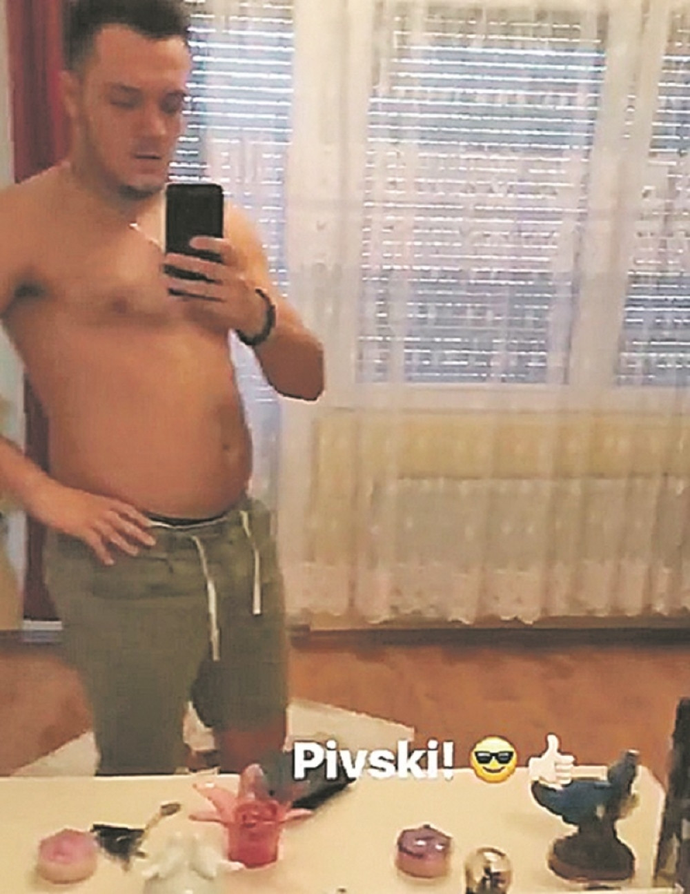 Gastoz pokazao pivski stomak