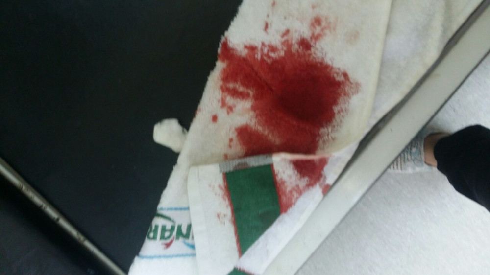 Kutlačom mi rascopao glavu!