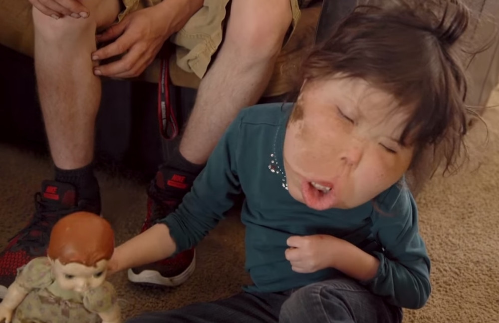 Niko ne zna od čega boluje ova devojčica