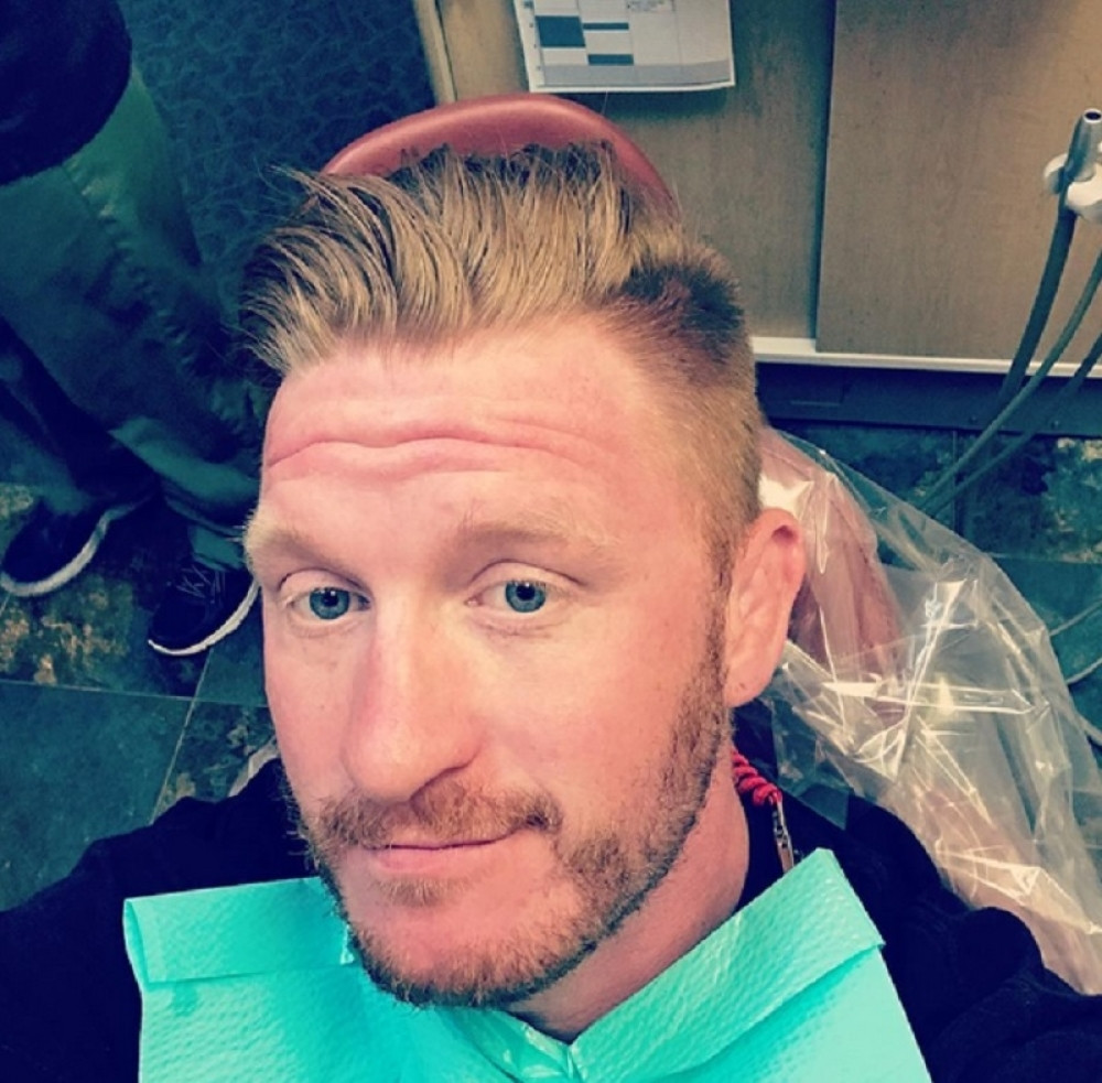 MMA borac ostao bez prsta (UŽASAVAJUĆI FOTO)