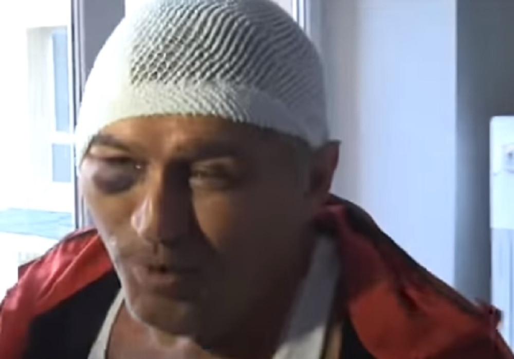 Majmun napao čuvara jer je "gledao" njegovu dragu! (VIDEO)