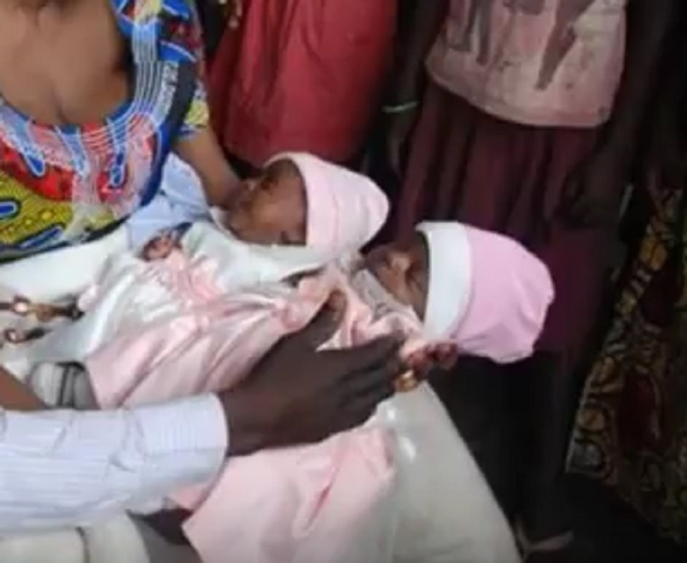 Bebe sijamske bliznakinje vozili 15 sati kroz džunglu do doktora (VIDEO)