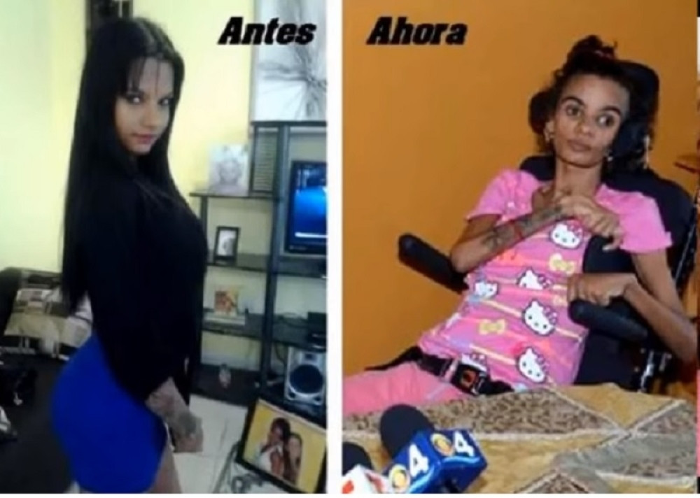 Tinejdžerka (18) ugradila silikone i sebi uništila život! (VIDEO)