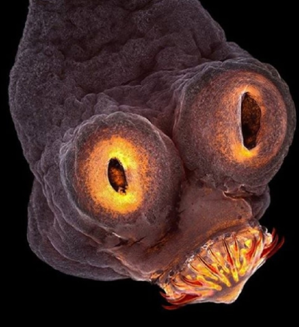 Ovi simptomi ukazuju na to da ovo stvorenje živi u vama (FOTO)