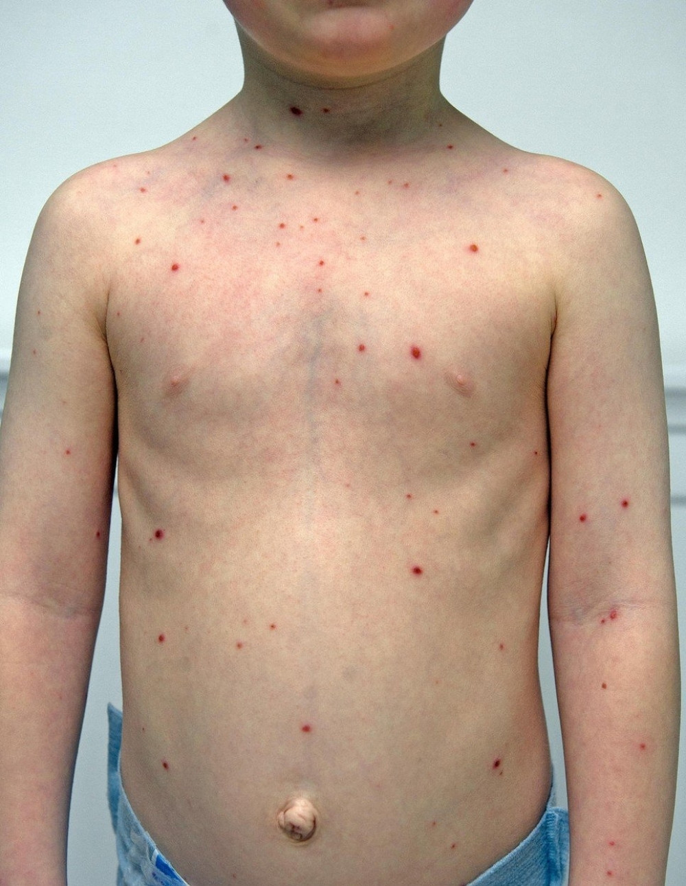 Male boginje dobili i Beograđani koji nisu bili u kontaktu sa zaraženima!