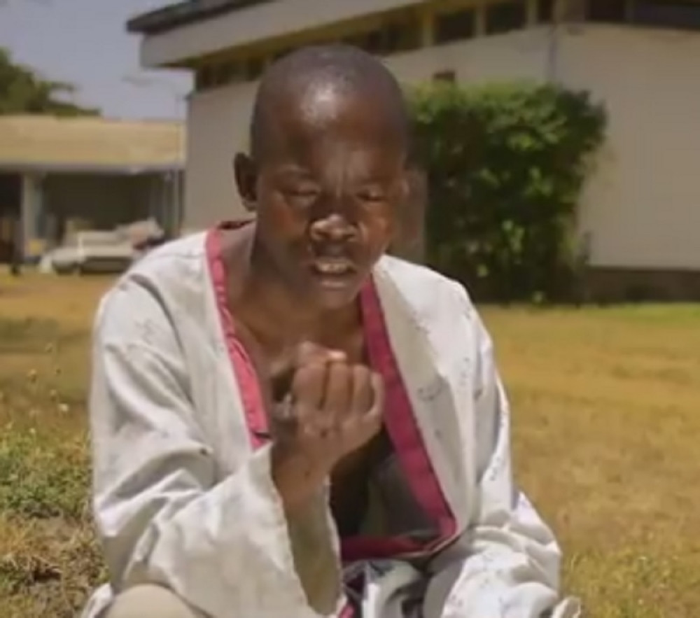 Testisi mu bili veći 20 puta, nije mogao da hoda, ni da ima seks