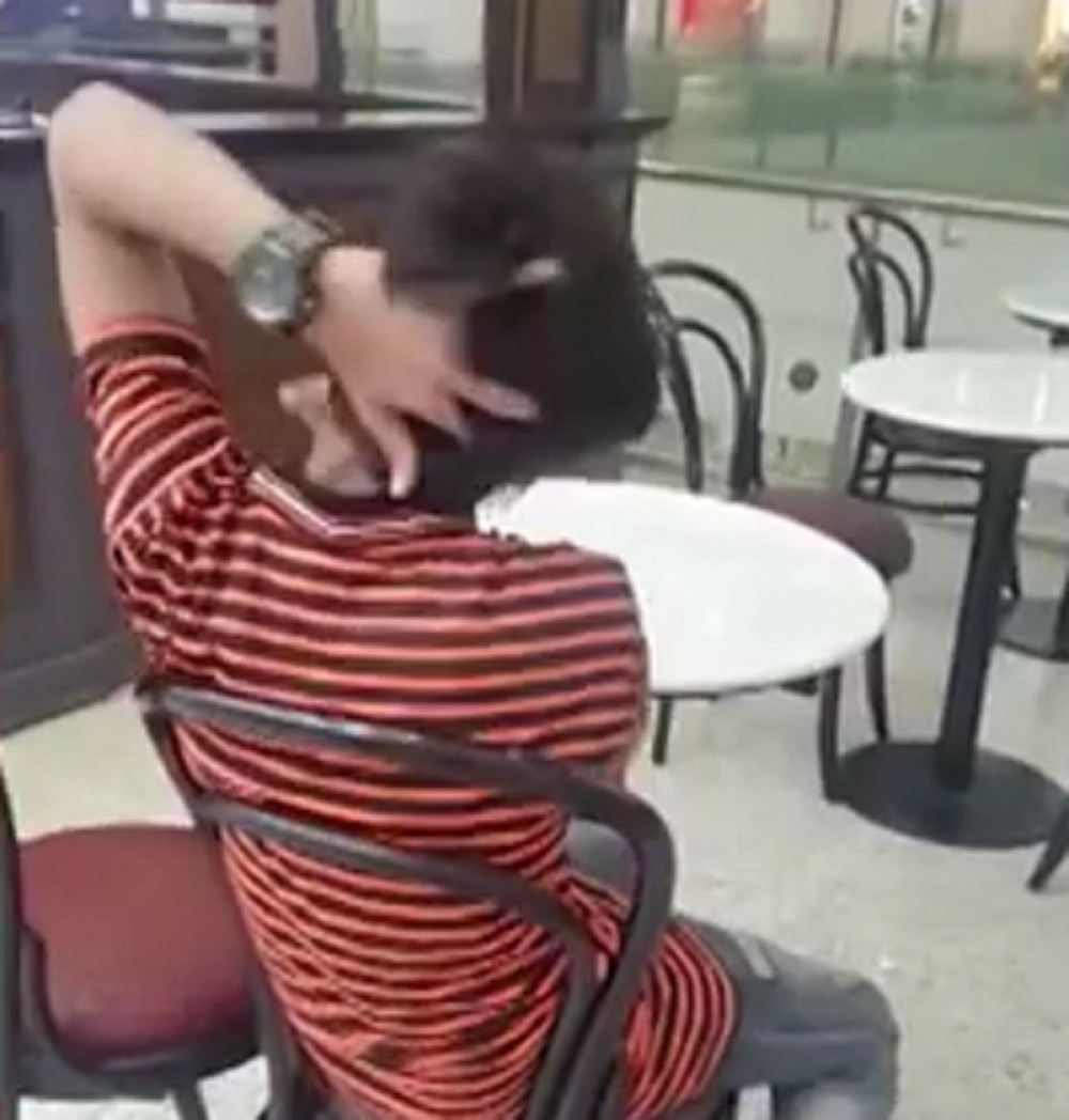 Dečak može da okrene glavu naopako