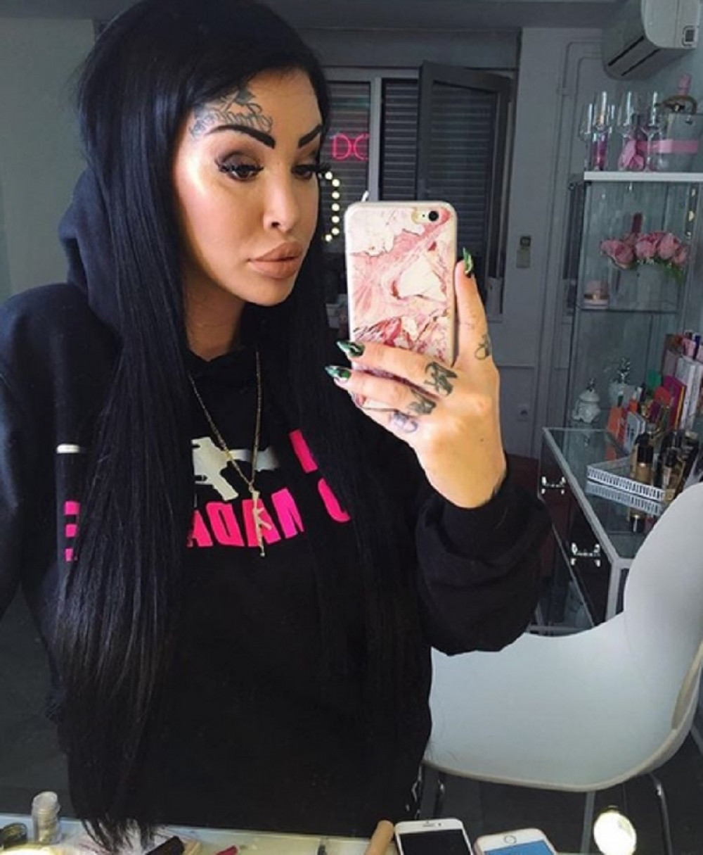 Anđela Veštica ovako izgleda nakon što je spržila kožu!