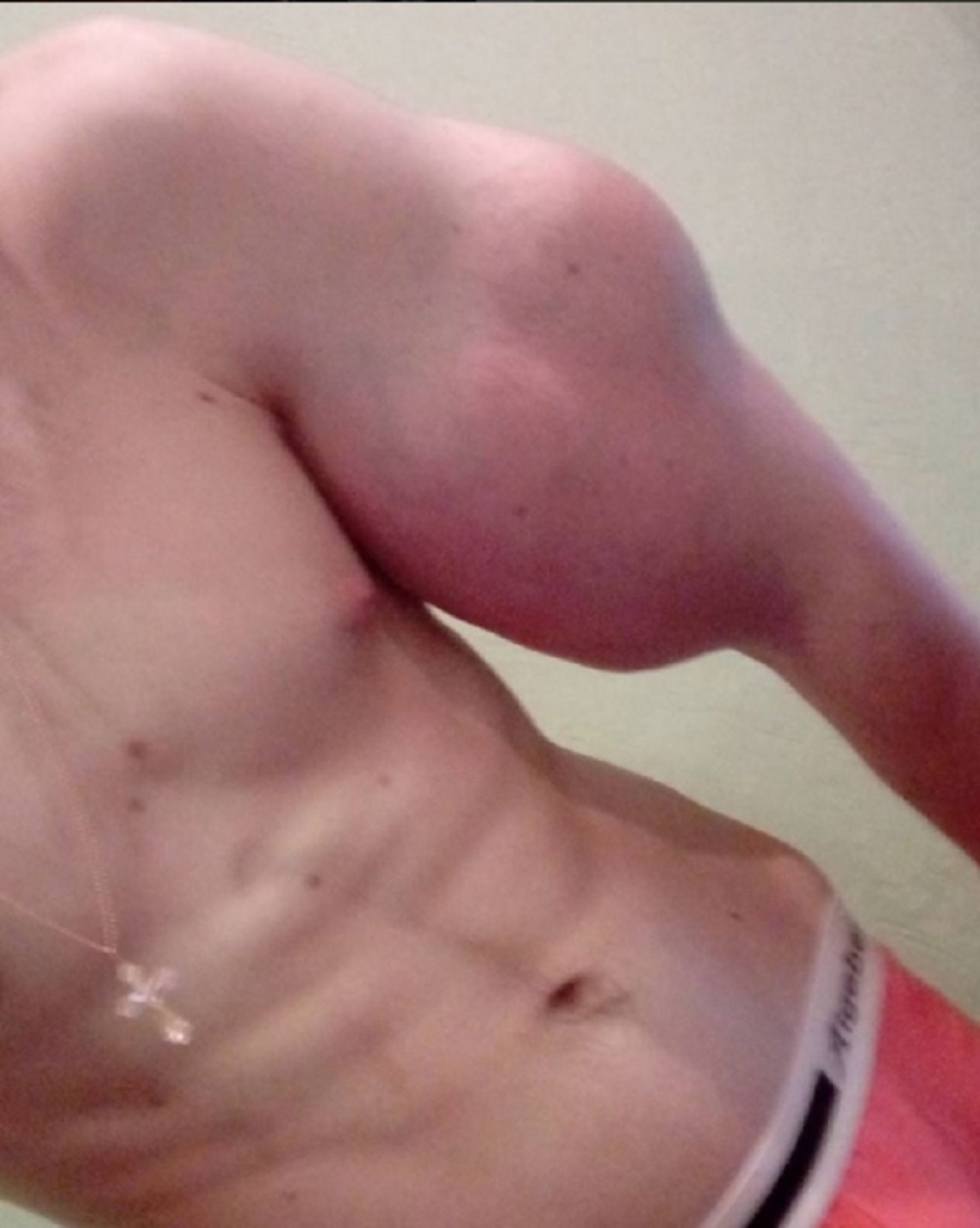 Ubrizgava hemiju u ruke da bi imao veći biceps!