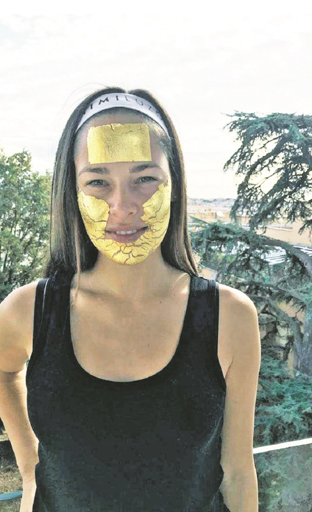 Ana i Švajni zatezali lice!