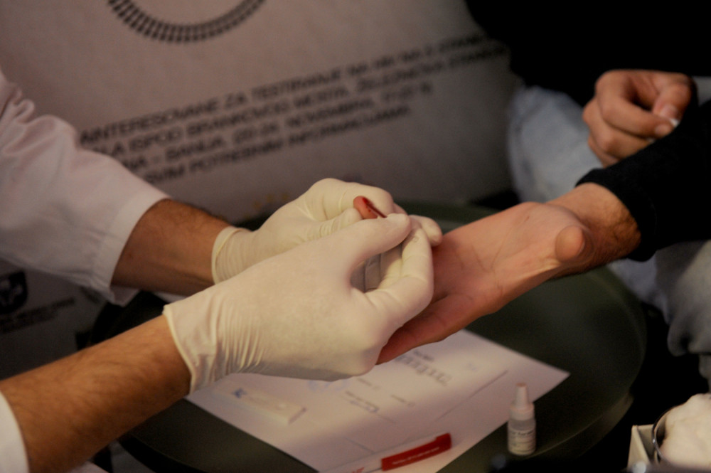 Epidemiolozi upozoravaju da u Srbiji imamo koncentrisanu epidemiju među gej, transrodnim osobama i muškarcima koji imaju seks sa muškarcima!