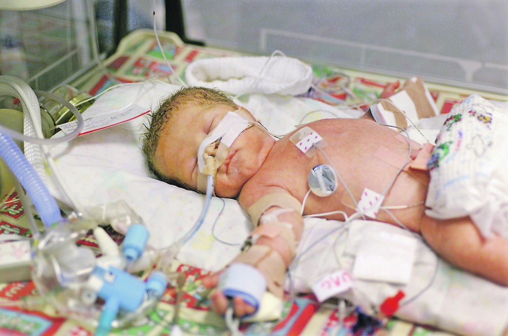 Roditelji su toliko izgladnjivali bebu da nije imala zube