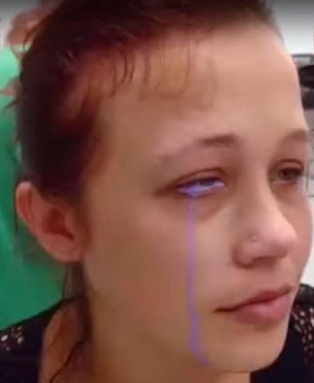 Proplakala ljubičaste suze, pa umalo ostala bez oka!