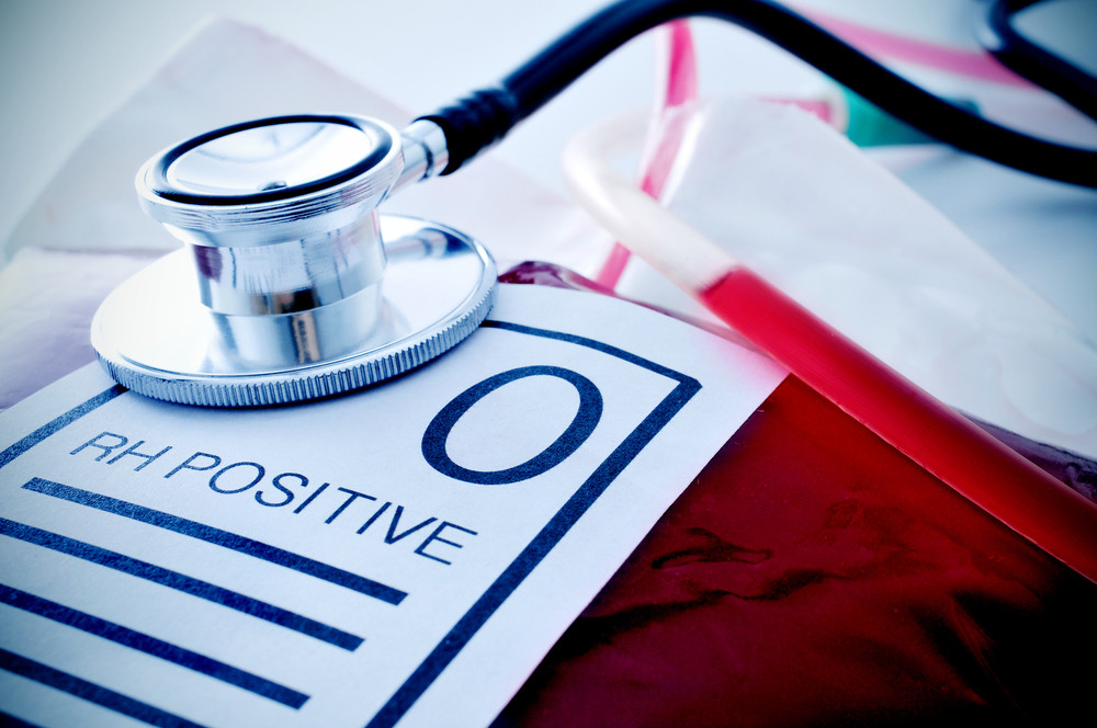 Ako ste AB krvna grupa čuvajte se moždanog udara, a evo ko ima najmanji rizik od koronarne bolesti srca