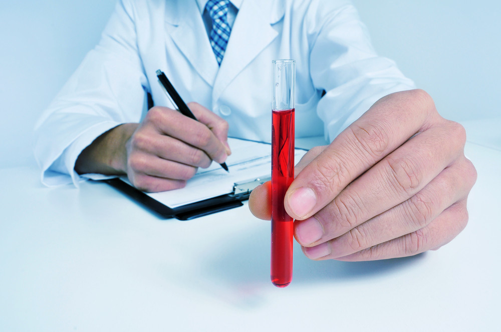 Besplatna provera nivoa šećera u krvi!