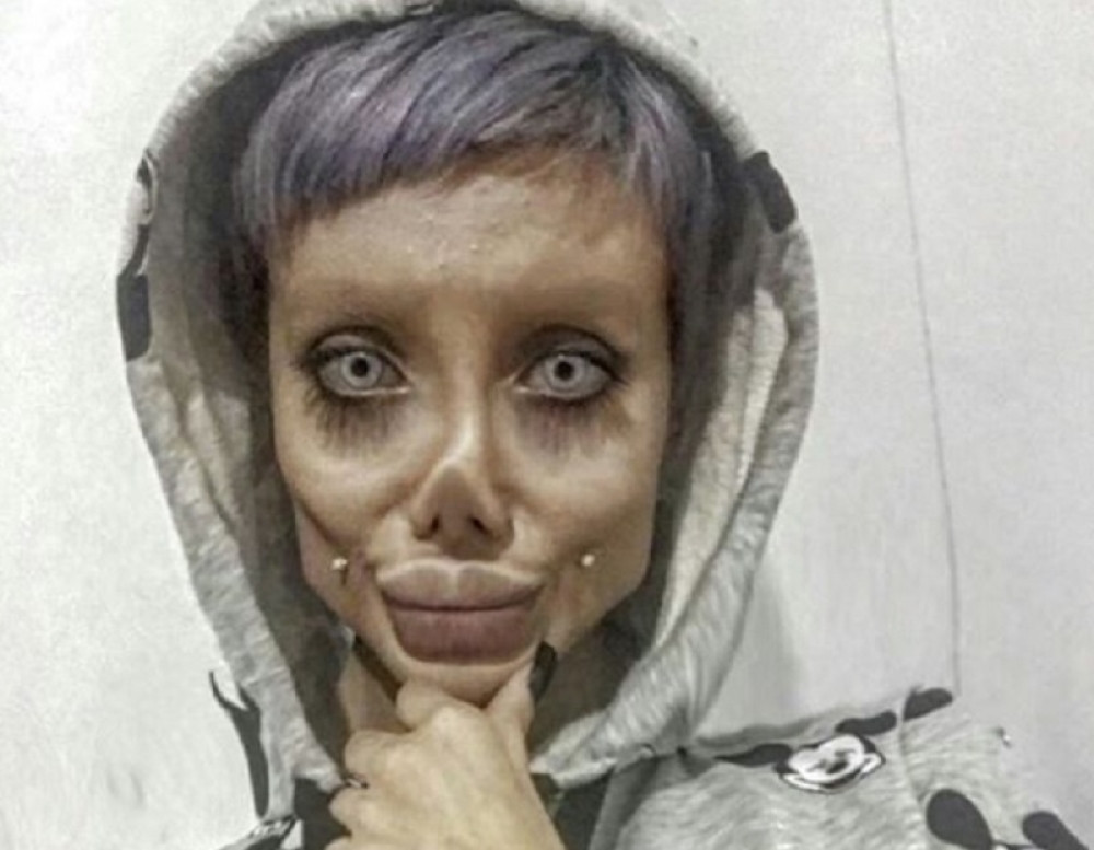 Izmislila da je imala operacije, evo kako stvarno izgleda! (FOTO)