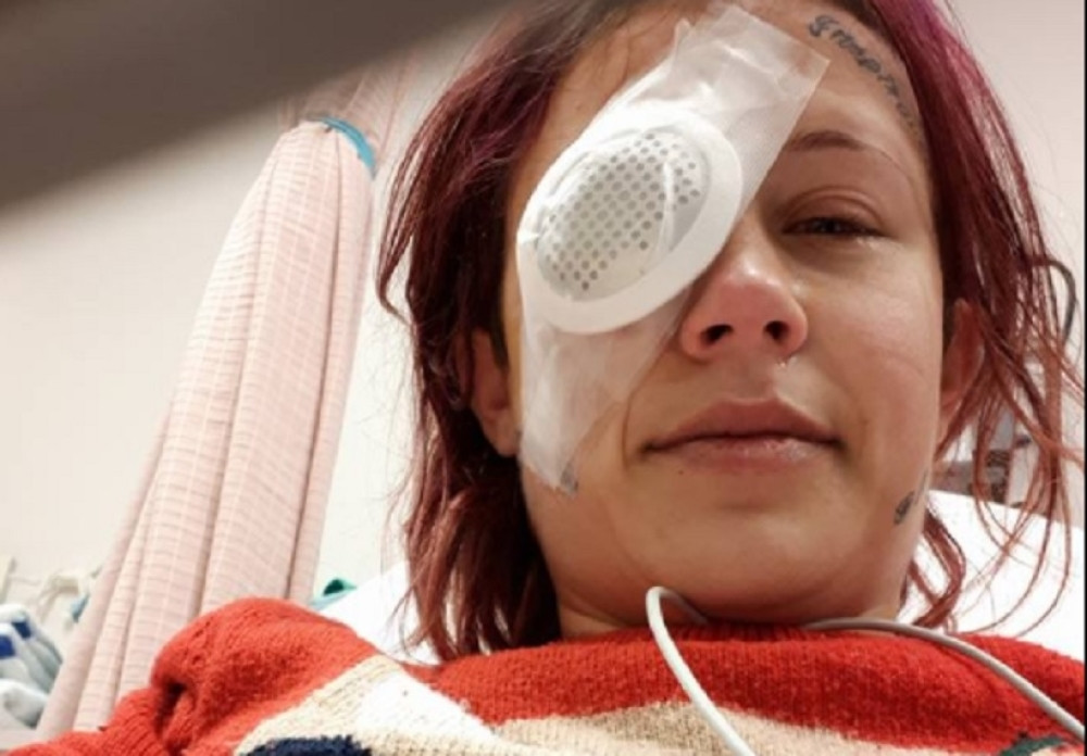 Pustila je dečka da joj tetovira oko, a sada će ostati bez njega! (FOTO)