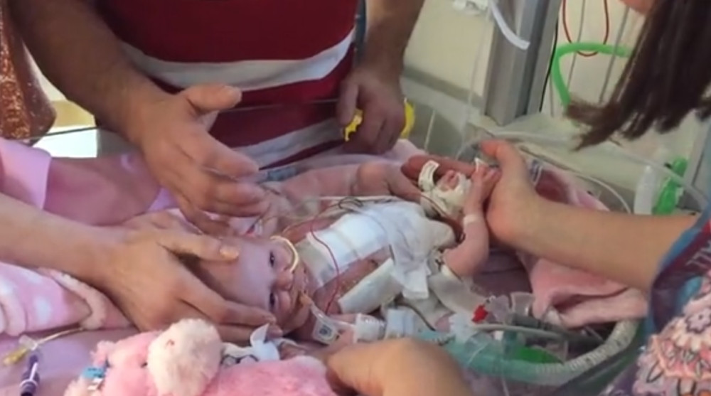 Beba rođena sa srcem van tela!