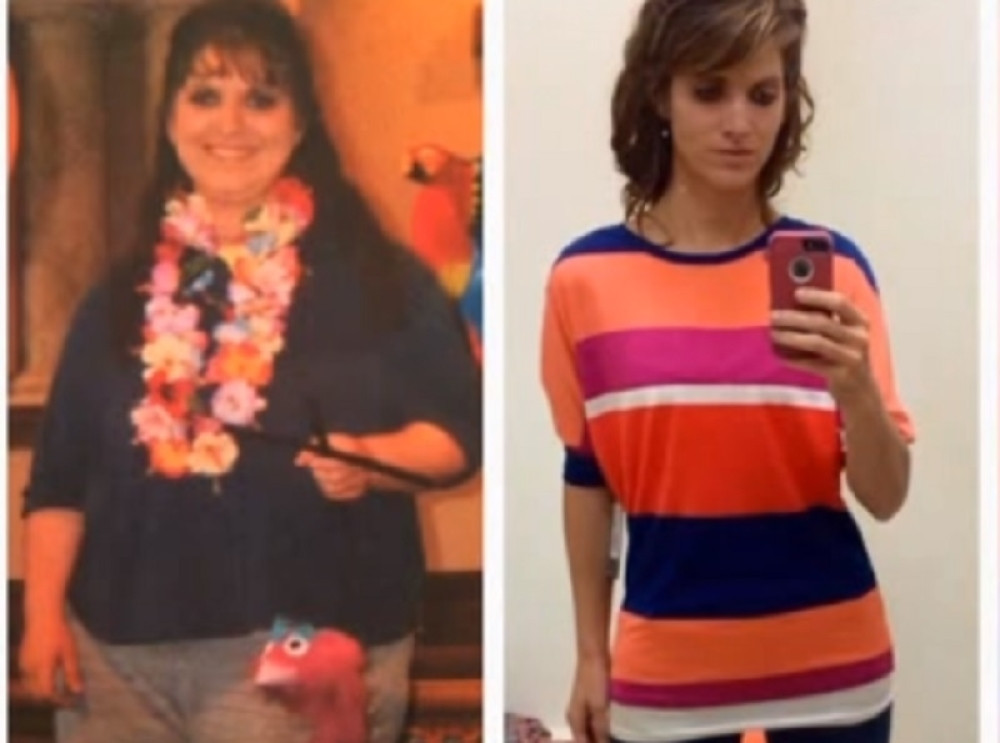 Ona jede samo tri namirnice i već je smršala 60 kilograma!