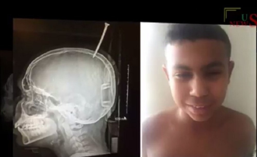 Pogledajte kako izgleda izbeći smrt za milimetar