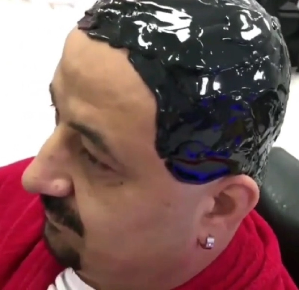 Hteo da depilira glavu, počeli da skidaju vosak, pa nastao haos! (VIDEO)