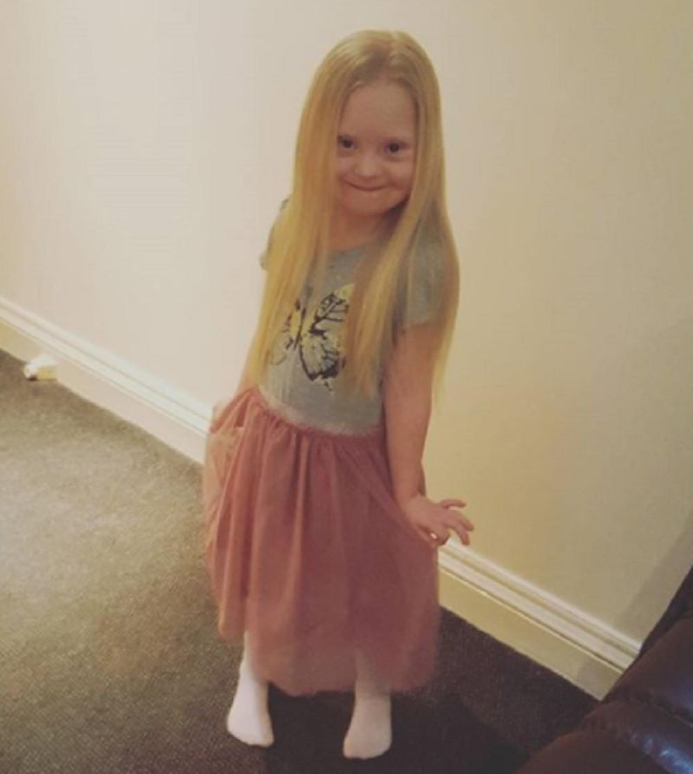 Ona ima Daunov sindrom, ali je to ne sprečava da bude uspešna manekenka (FOTO)