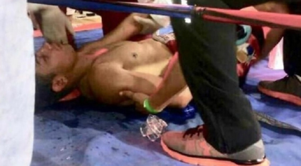 Bokser dobio izliv krvi u mozak, lekari se bore za njegov život!