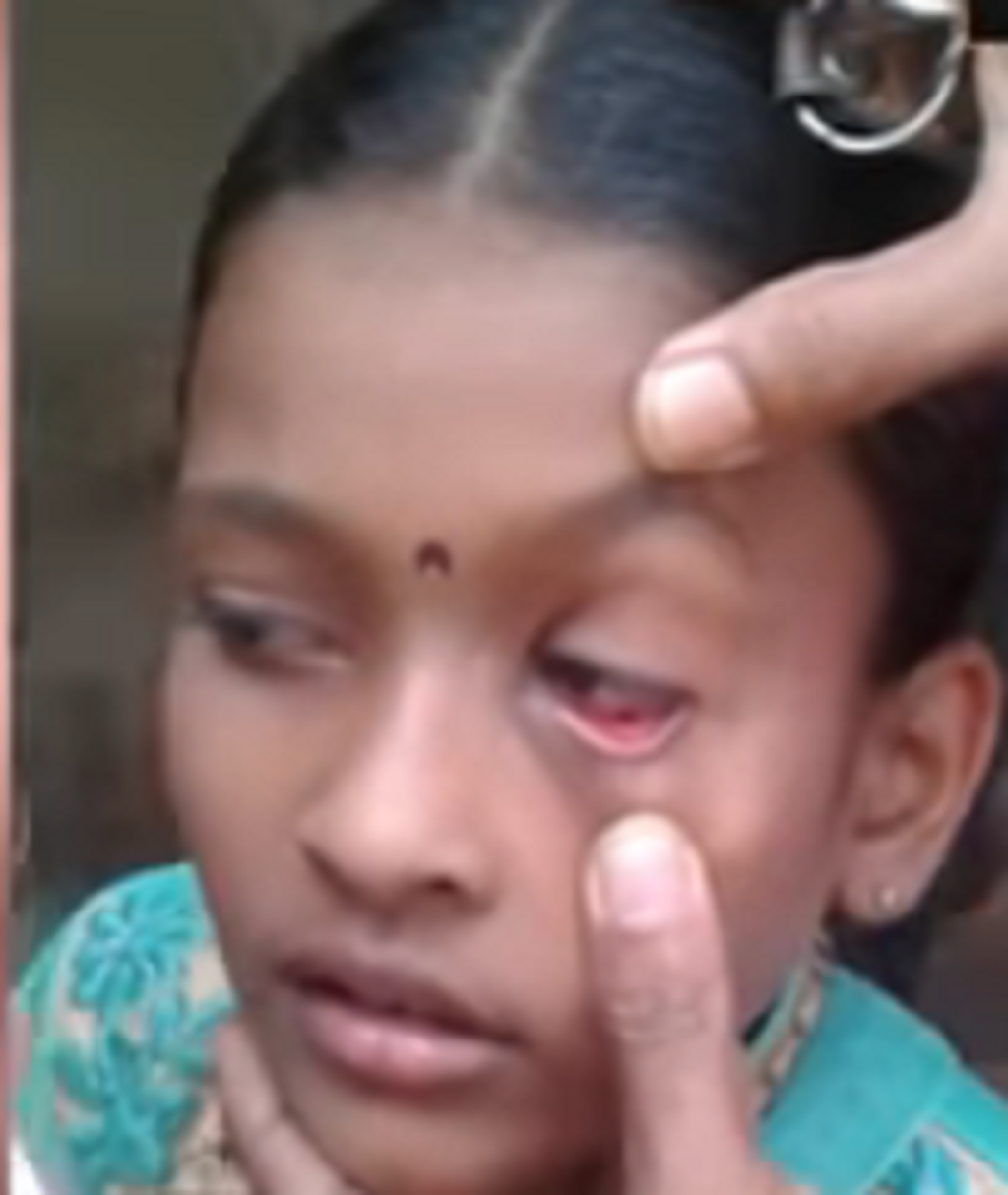 Devojčici izlaze mravi iz očiju!