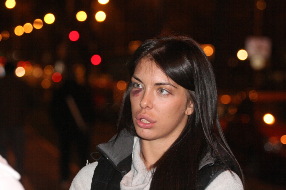 Nakon nasilja koje je preživela povukla se iz javnosti! Evo kako sada izgleda! (FOTO)