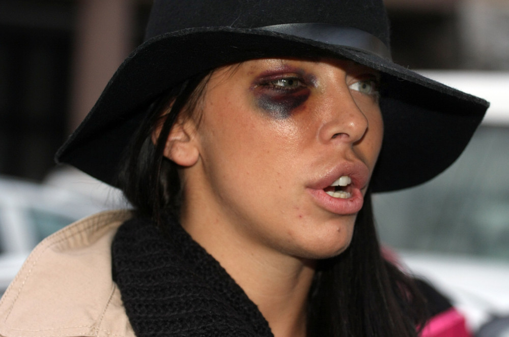 Voditelj ju je pretukao pre 4 GODINE, a sada je poslala JAKU PORUKU svima (FOTO)