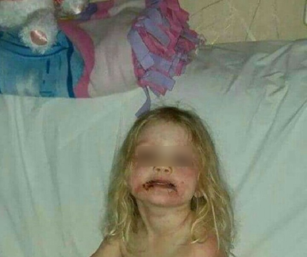 Devojčica zbog "bezazlene" igračke umalo umrla! (UZNEMIRUJUĆI FOTO)
