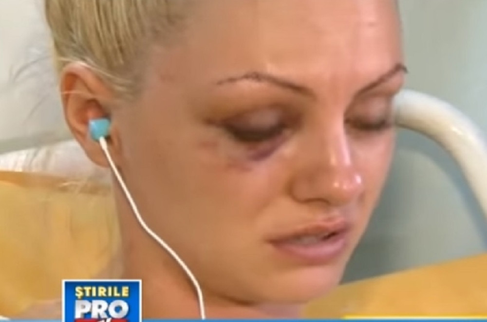 Pevačicu brutalno pretukao menadžer, pojavio se uznemirujuć snimak!