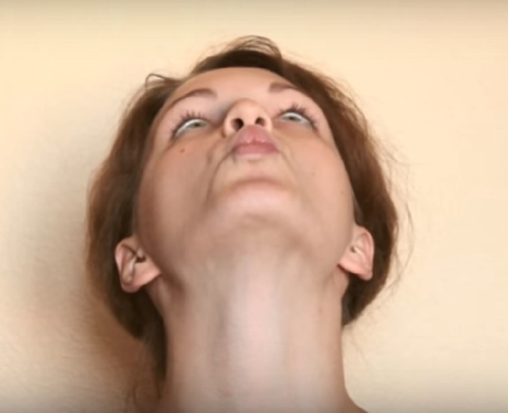 Rešite se podbratka pomoću ovih  vežbi!