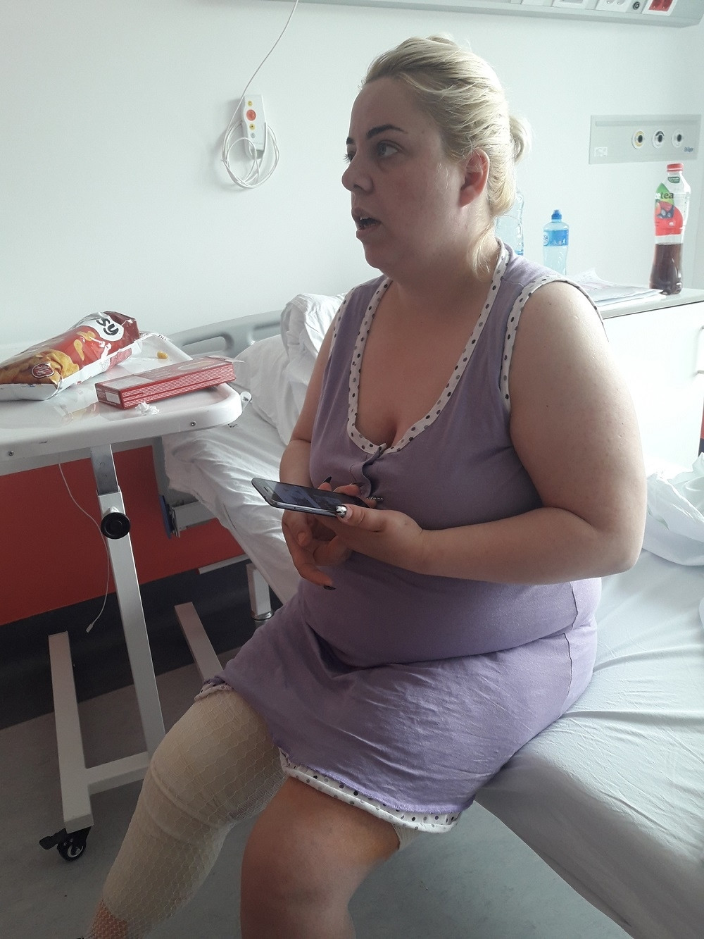 Emilija kojoj su spržili nogu tokom operacije žuči ponovo u bolnici!