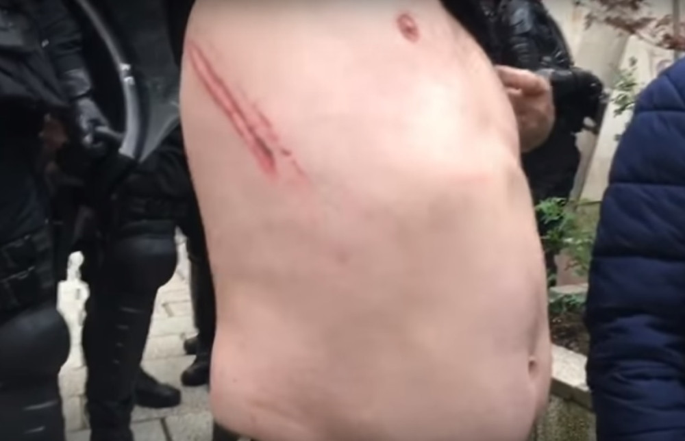 Sukob policije i demobilisanih boraca ispred Parlamenta FBiH