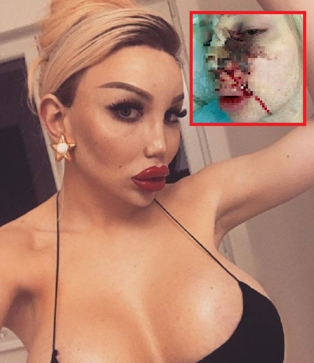 Bila je muškarac, a onda je potrošila 130.000 evra da bi izgledala kao lutka!