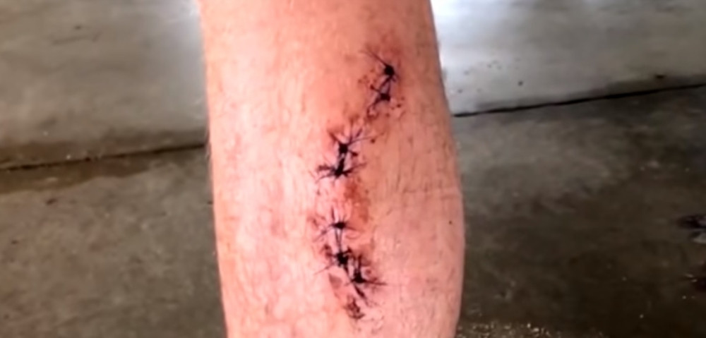 Momak (21) preživeo napade ajkule i medveda i ugriz zvečarke!