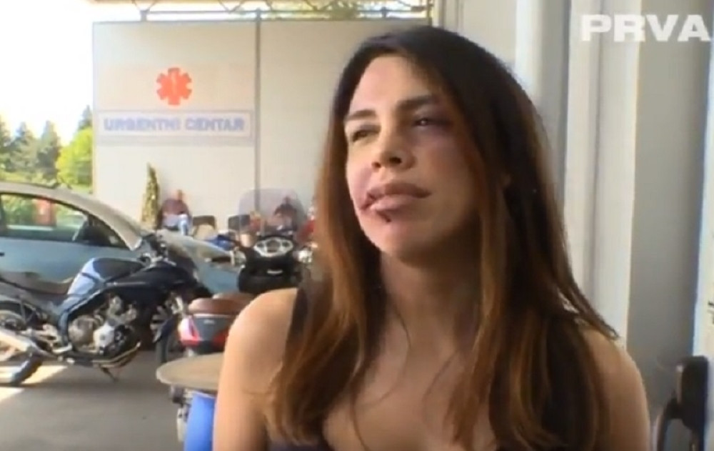 Pretučena Kaja završila u "Urgentnom centru"