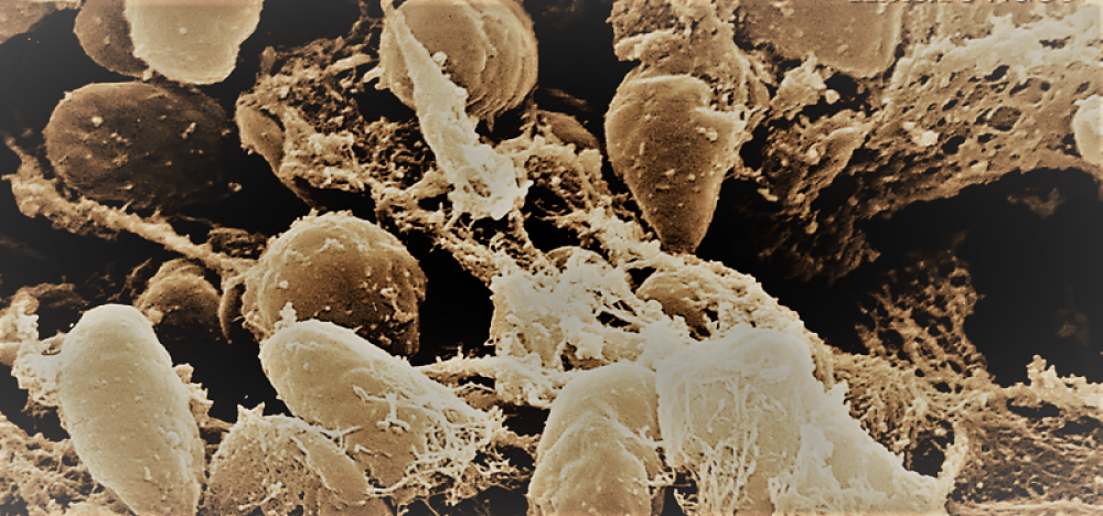 Kuga stigla u Kaliforniju, muškarac se zarazio dok je šetao psa!