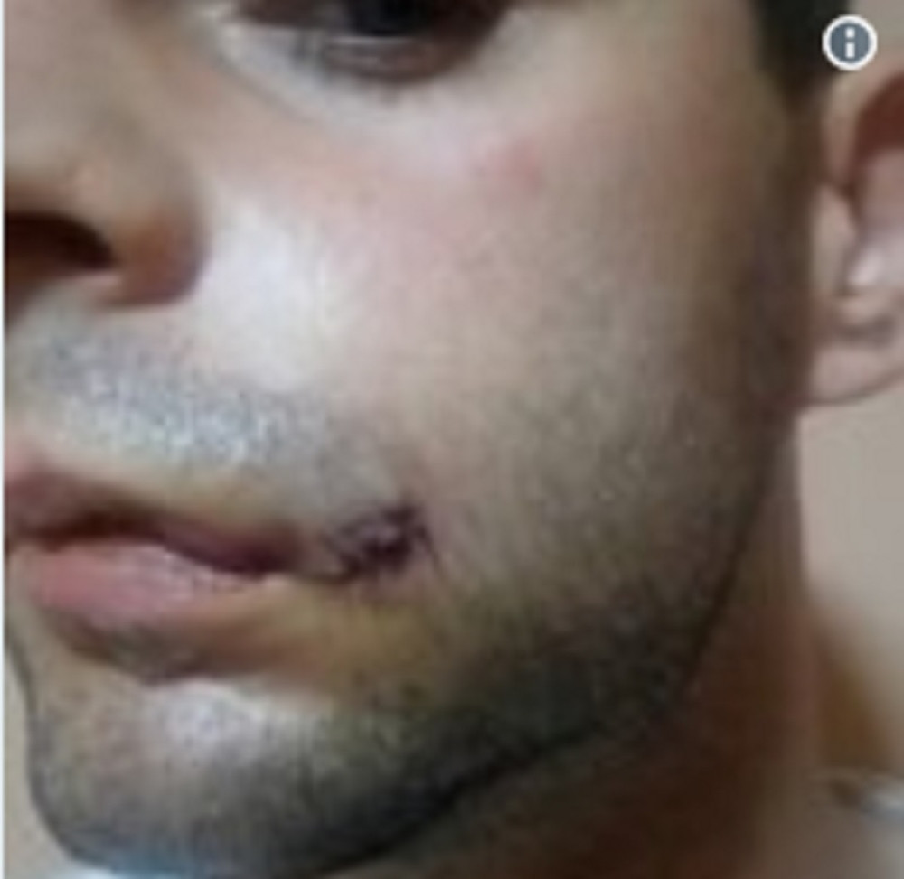 Evo kako su MANIJACI brutalno PRETUKLI POLICAJCA na Ibarskoj! (FOTO)