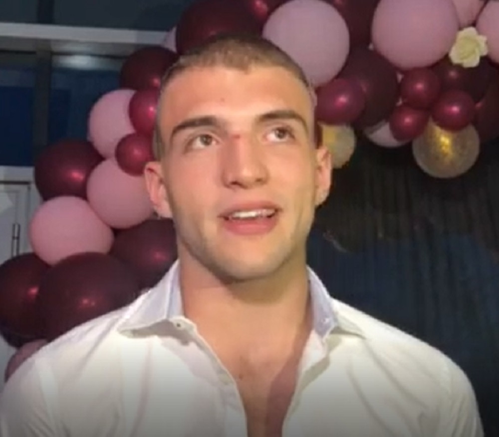 Veljko među prvima došao na Cecin rođendan, pa pokazao POVREDU na glavi!