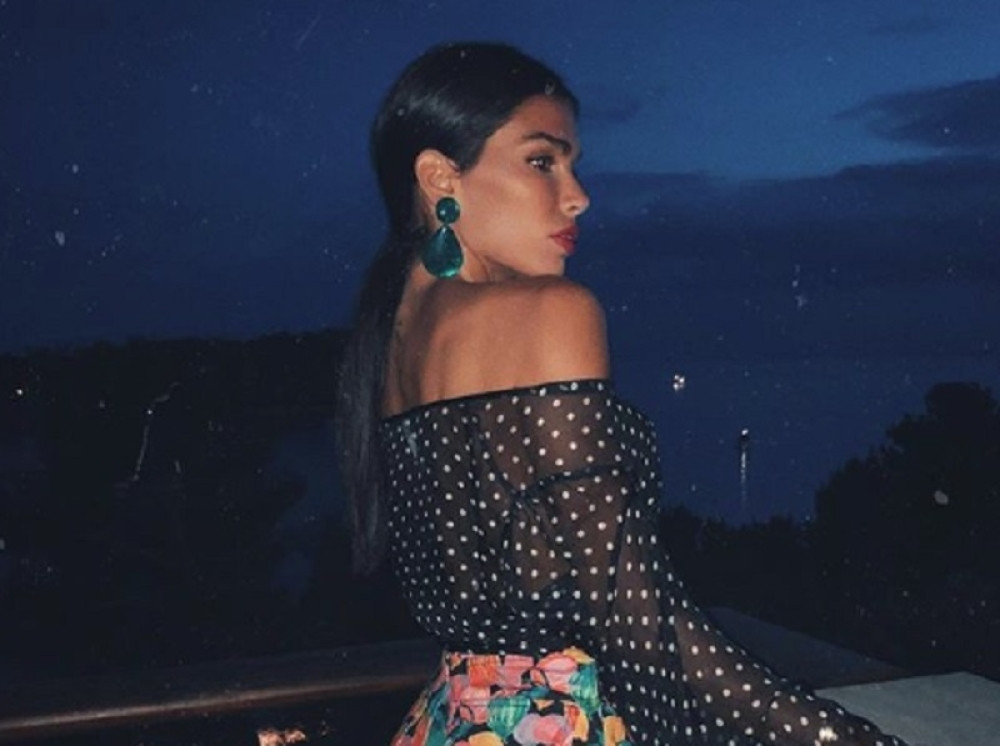 Tragedija najlepše Srpkinje: Pokušala da se UBIJE, izgorelo joj je 50 odsto kože, a danas joj SVI ZAVIDE